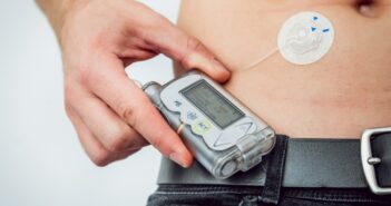Eine Iinsulinpumpe sorgt für mehr Lebensqualität. (Foto: AdobeStock 229040746 romaset)